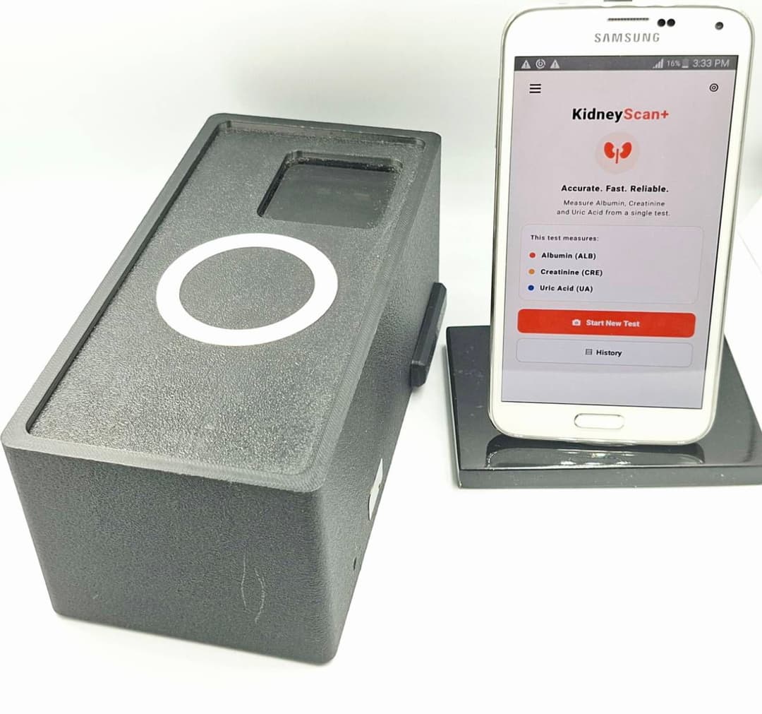 KidneyScan+: An AI-powered Mobile App for Screening CKD & Kidney Stones