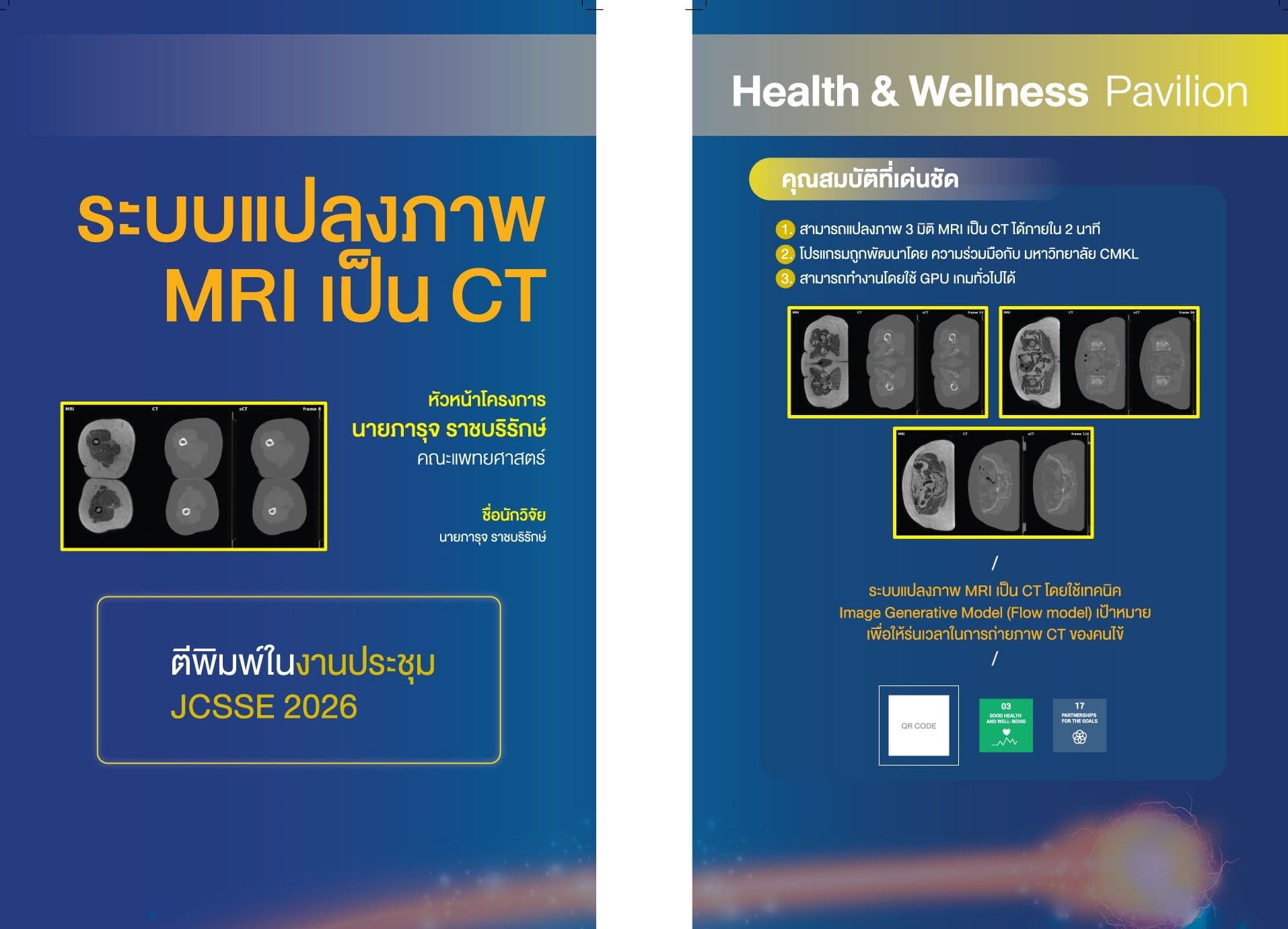 MRI-to-CT synthesis system